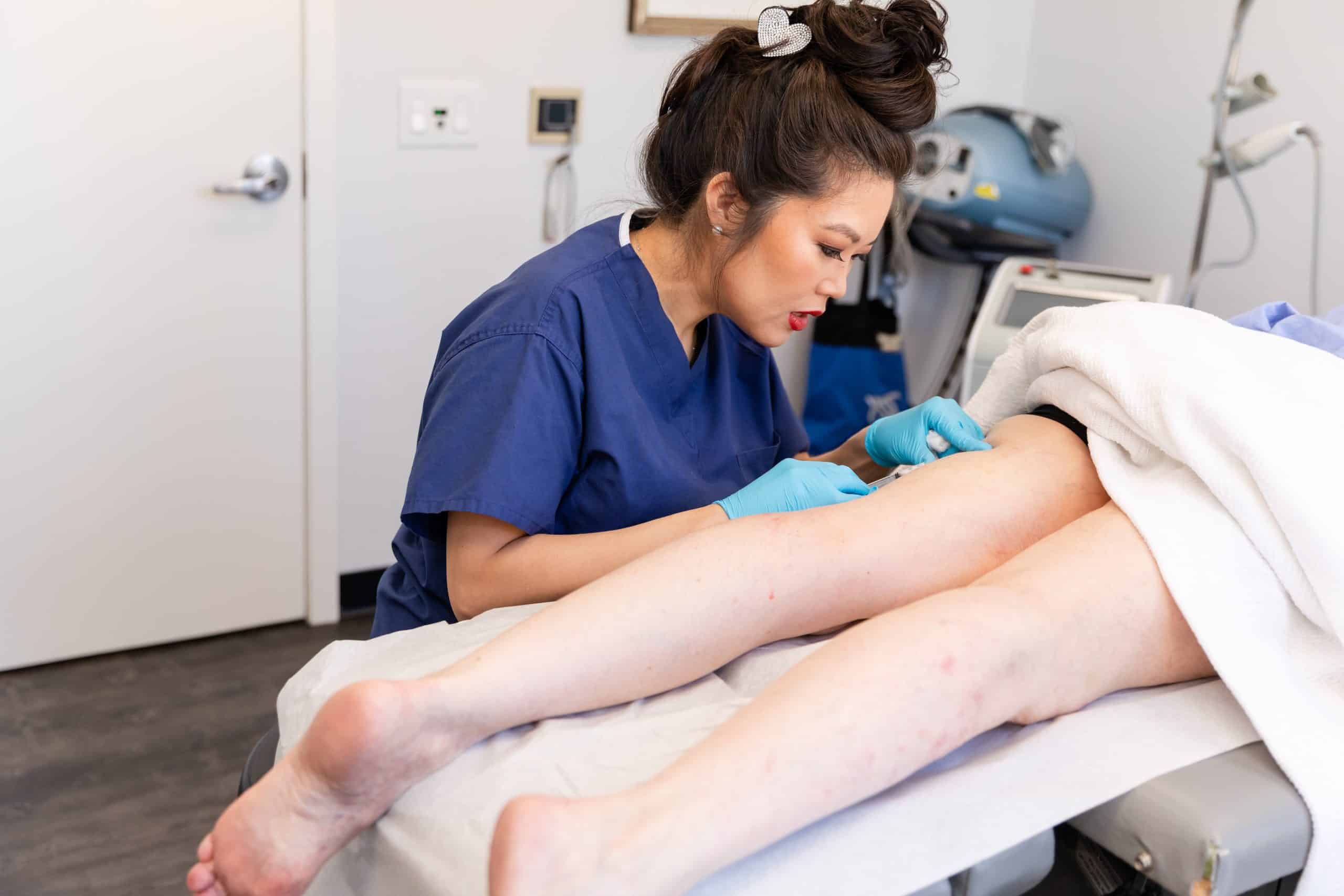 leg vein treatment