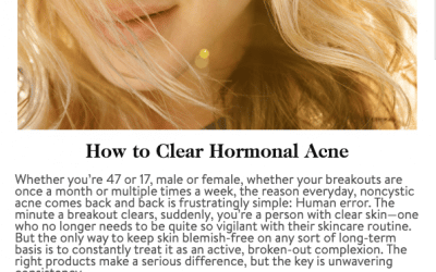 “How to Clear Hormonal Acne” Robert T. Anolik, M.D., featured in goop magazine