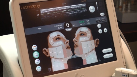 LSSCNY Ultherapy Treatment New York NY