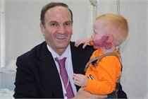 birthmark-removal-treatment-new-york Image of a Doctor holding a toddler with Hemangiomas, a bright red birthmark that shows up at birth, New York, NY