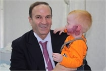 Image of a Doctor holding a toddler with Hemangiomas, a bright red birthmark that shows up at birth, New York, NY