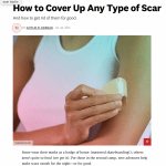 Roy G. Geronemus, M.D., discusses scars in Women’s Health magazine