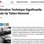 Combination Technique Significantly Speeds Up Tattoo Removal