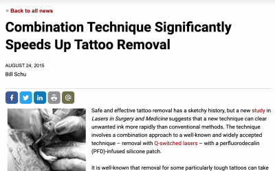 Combination Technique Significantly Speeds Up Tattoo Removal