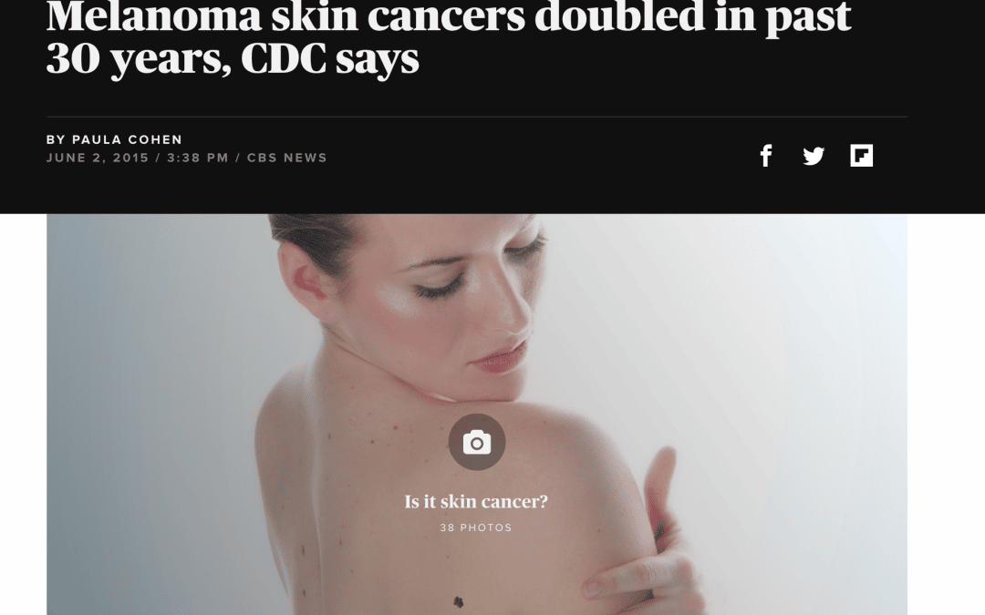 melanoma skin cancer treatment in new york