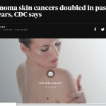 Melanoma skin cancers doubled in past 30 years – CBS News