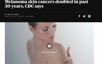 Melanoma skin cancers doubled in past 30 years – CBS News