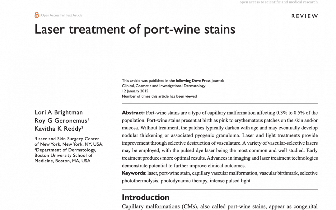 port wine stain treatment article in new york