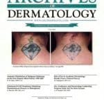 New Publication on Tattoo Removal Featured on the Cover of Archives of Dermatology