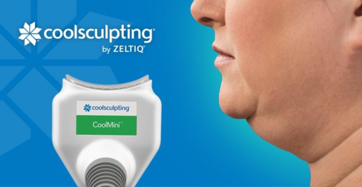 coolsculpting treatment for double chin