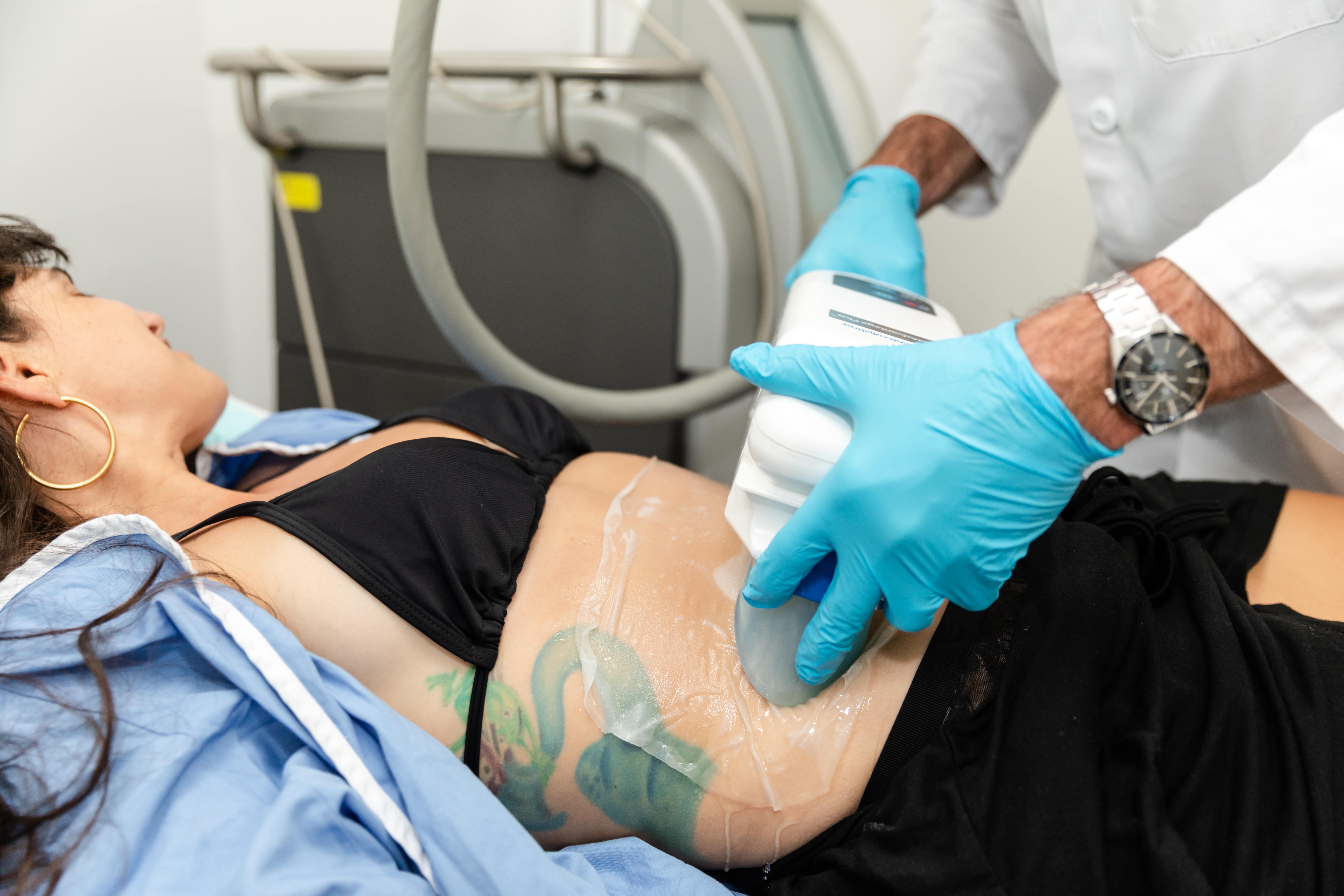 Coolsculpting Elite Treatment on Female Patient New York City, NY Coolsculpting Elite Treatment on Female Patient New York City, NY