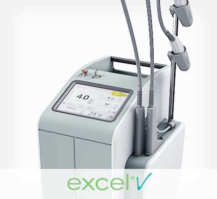 rosacea laser treatment-NY-NY Excel V laser used for rosacea treatment in NY, NY