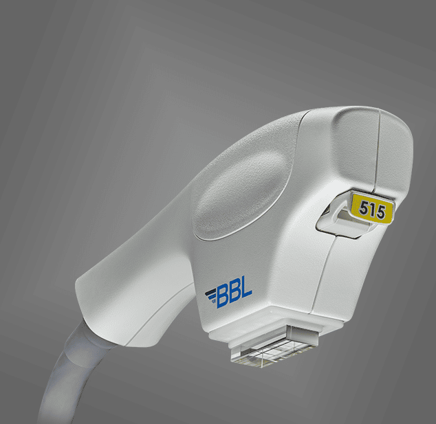 rosacea laser treatments-NYC-NY broadband light laser used to rosacea treatments in New York City