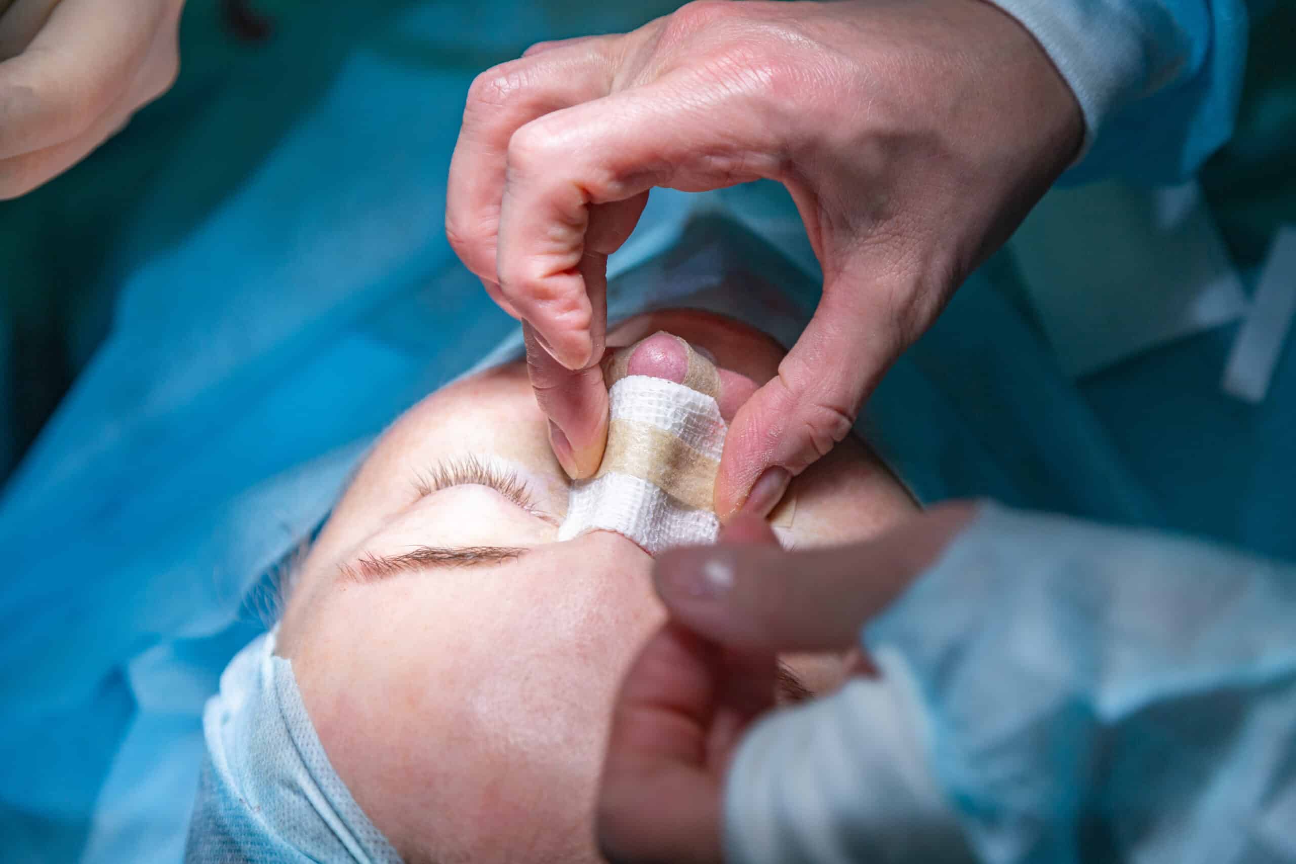 Surgeon,And,His,Assistant,Performing,Cosmetic,Surgery,On,Nose,In Model image used to depict rhinophyma treatment in NYC, NY.