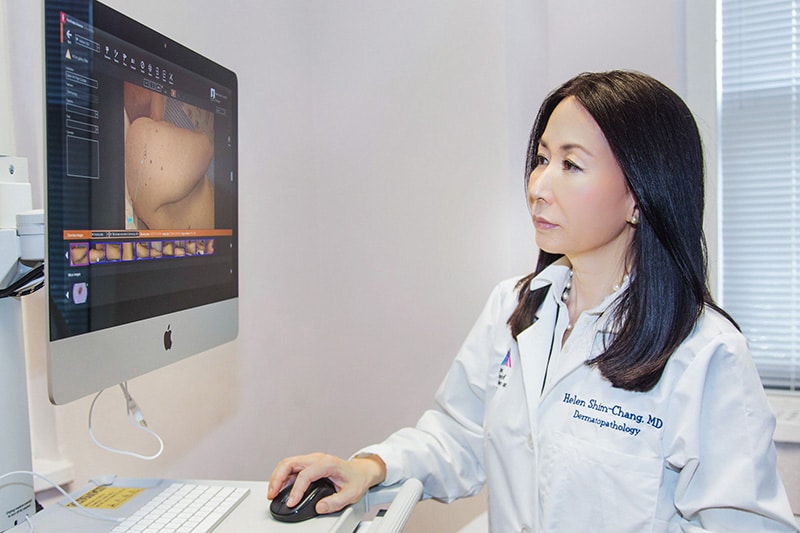 skin cancer screening-New York City dermatologist looking at a computer monitor during a skin cancer screening in NYC