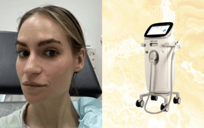 What Is Sofwave? Everything You Need to Know About the Skin-Tightening Device