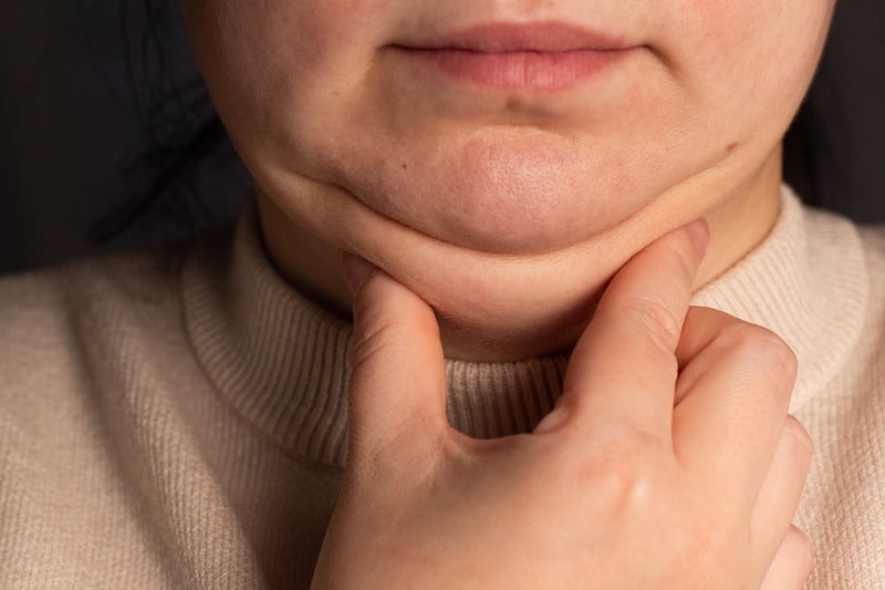 Jawline and Neck Contouring