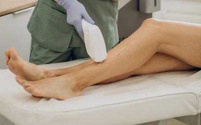 What to Expect From Laser Hair Removal Treatment