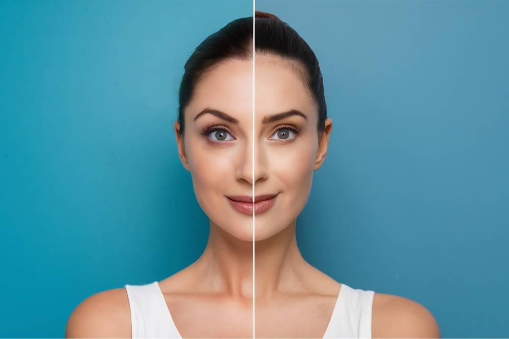 Dysport vs. Botox Which is Right For You