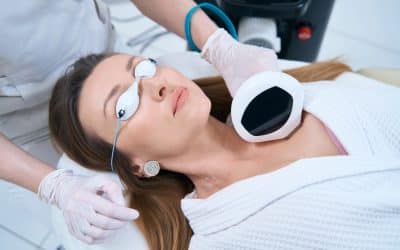 Laser Treatments for Age Spots and Brown Spots: What You Need to Know