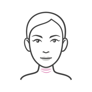WRINKLES AND LAXITY OF THE NECK