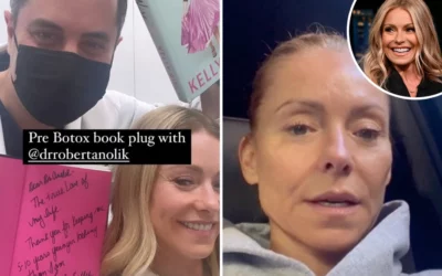 NO WRINKLE IN TIME Kelly Ripa shares bare-faced pic at botox appointment as Live host thanks doctor for making her look ’10 years younger’