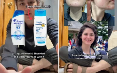 Viral TikTok trend has people washing their faces with Head & Shoulders shampoo