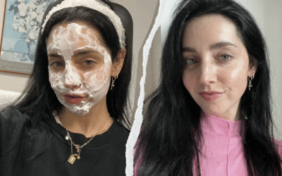 I Tried Sofwave For Skin-Firming & I’m More Sculpted Than Ever