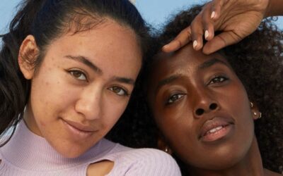 How to treat melasma and hyperpigmentation, according to dermatologists