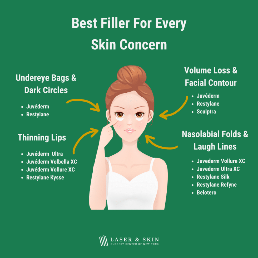 Facial Fillers Guide Which One to Choose? Laser NY