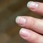 Here’s What Those White Spots On Your Nails Mean & How You Can Prevent Them