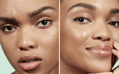 The Best Primers For Acne-Prone Skin, According To Dermatologists