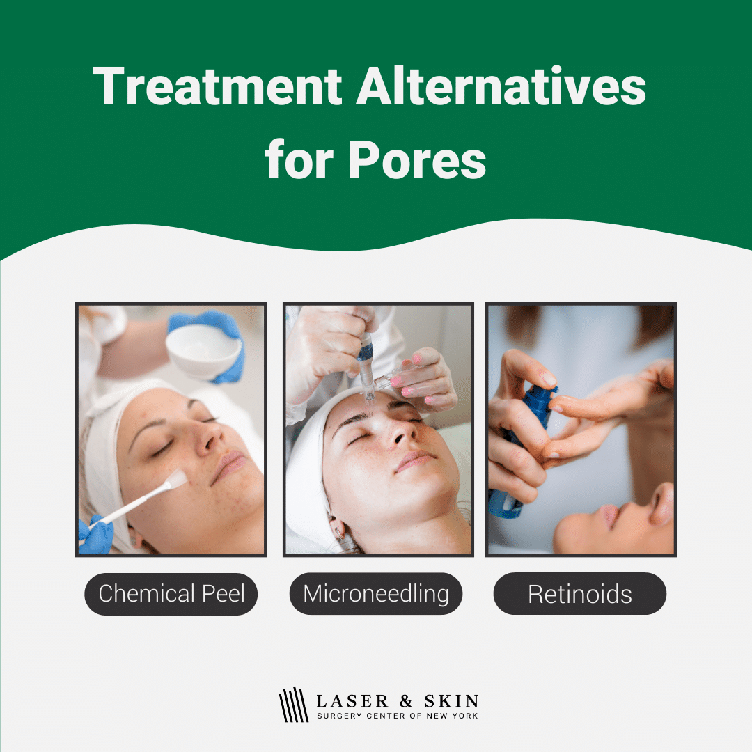 treatment-alternative-for-pores-lsscny-nyc