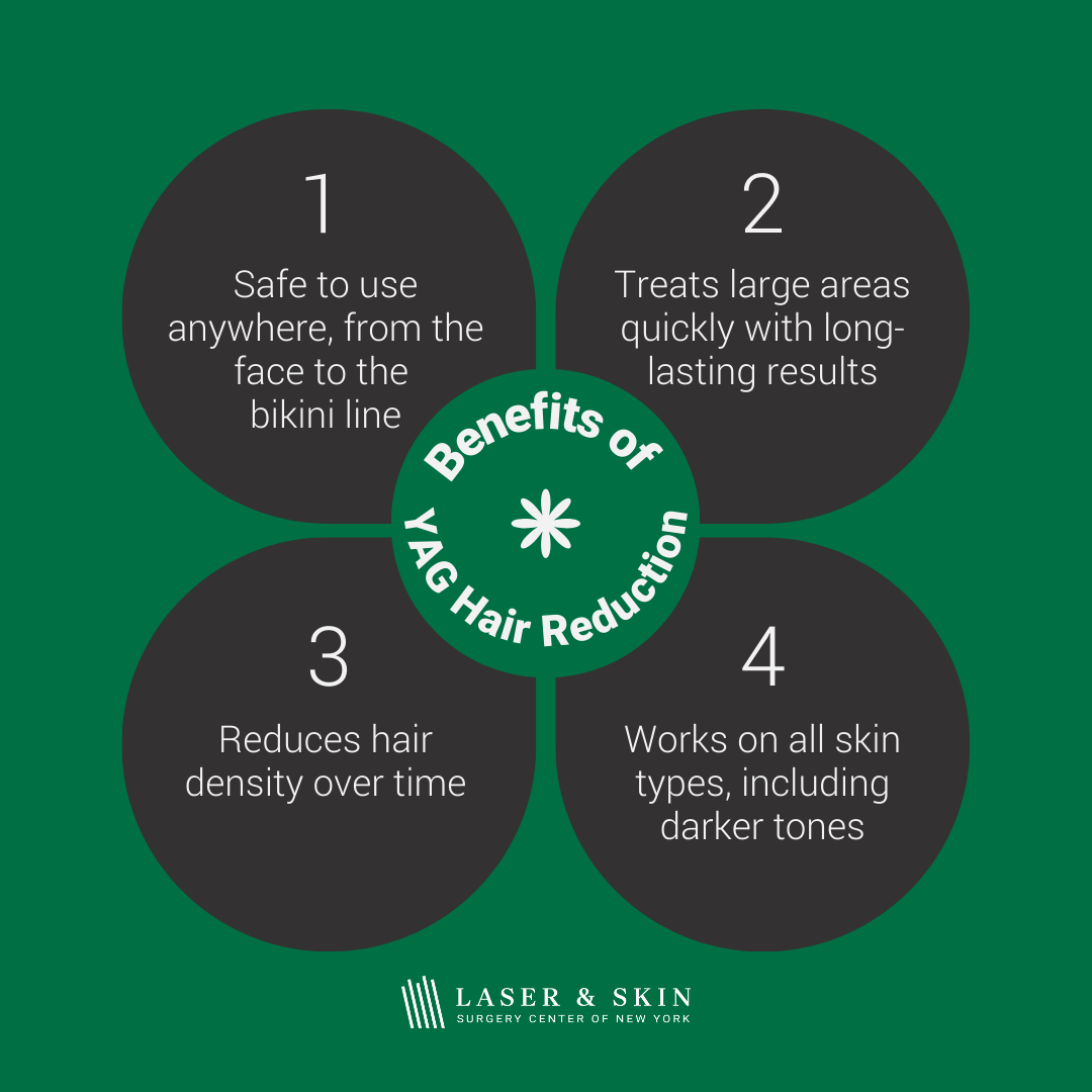 lsscny-nyc-yag-laser-hair-removal nd yag laser benefits infographic
