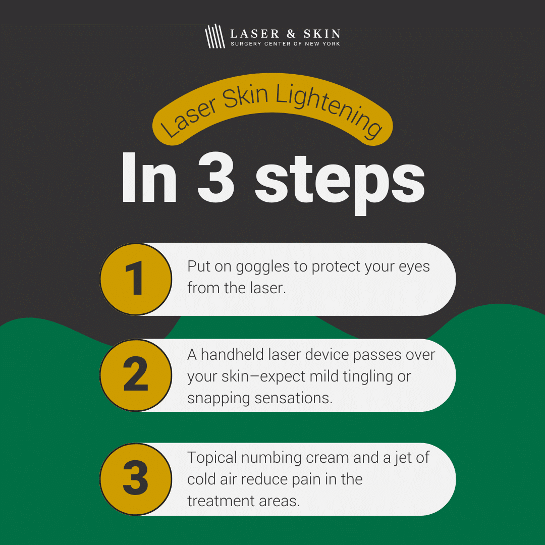 lsscny-nyc-laser-skin-lightening-steps what to expect from laser skin lightening procedure infographic