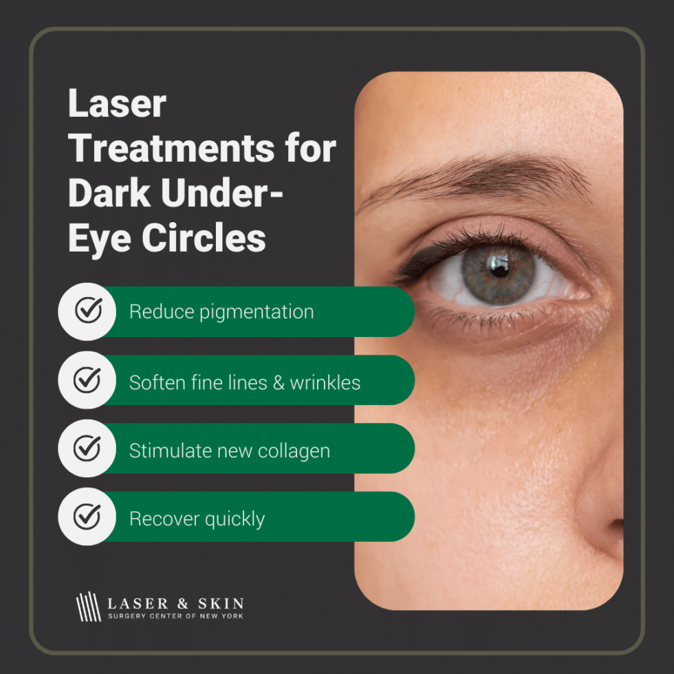 Laser Treatment For Dark Under Eye Circles In New York Laser Ny