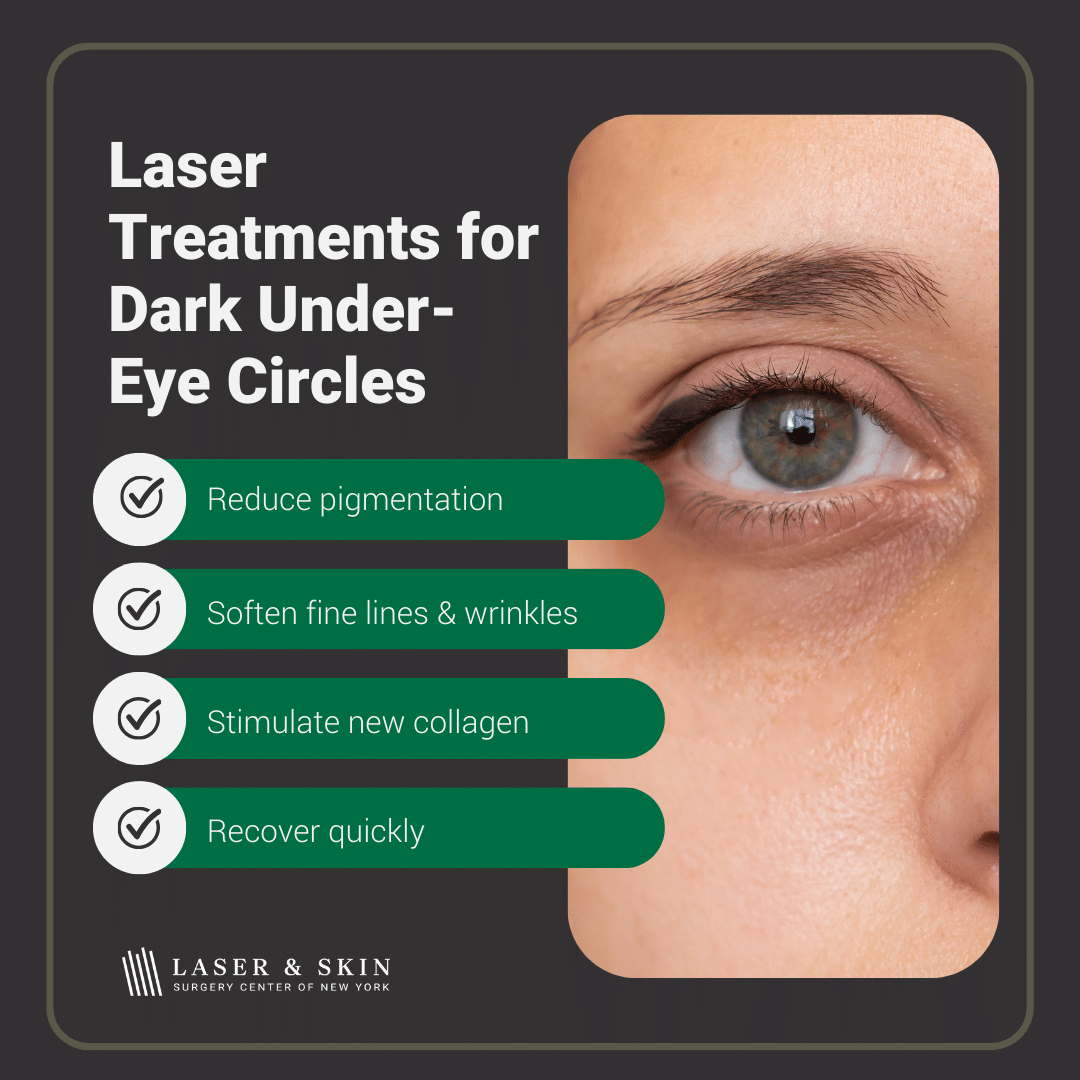 Laser treatment for dark under-eye circles in New York - Laser NY