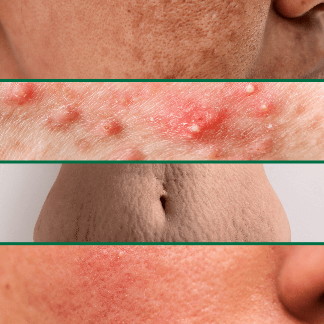 lsscny-nyc-safe-during-pregnancy1 how pregnancy affects the skin infographic