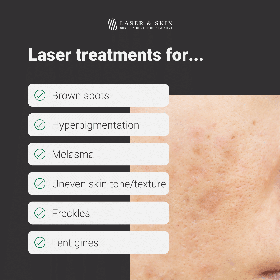 lsscny-nyc-laser-for-sun-damage laser treatments infographic
