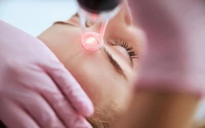 Expert dermatologists answer the most popular questions about laser skin resurfacing
