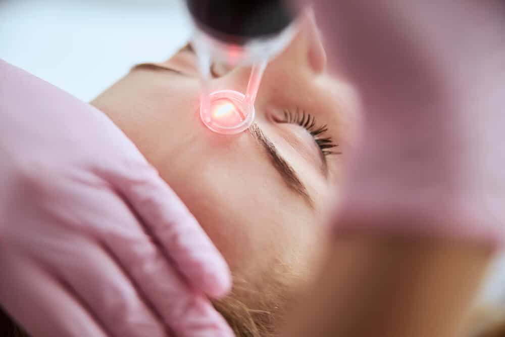 Expert dermatologists answer the most popular questions about laser skin resurfacing