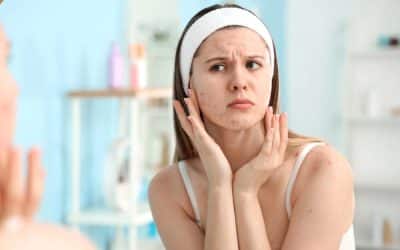 Is your acne hormonal or bacterial? Expert dermatologists share