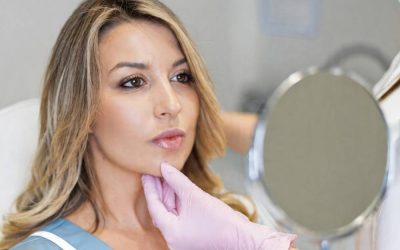 Is Lip Filler Migration Really a Thing? Dermatologists Explain
