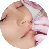 Dermal Fillers