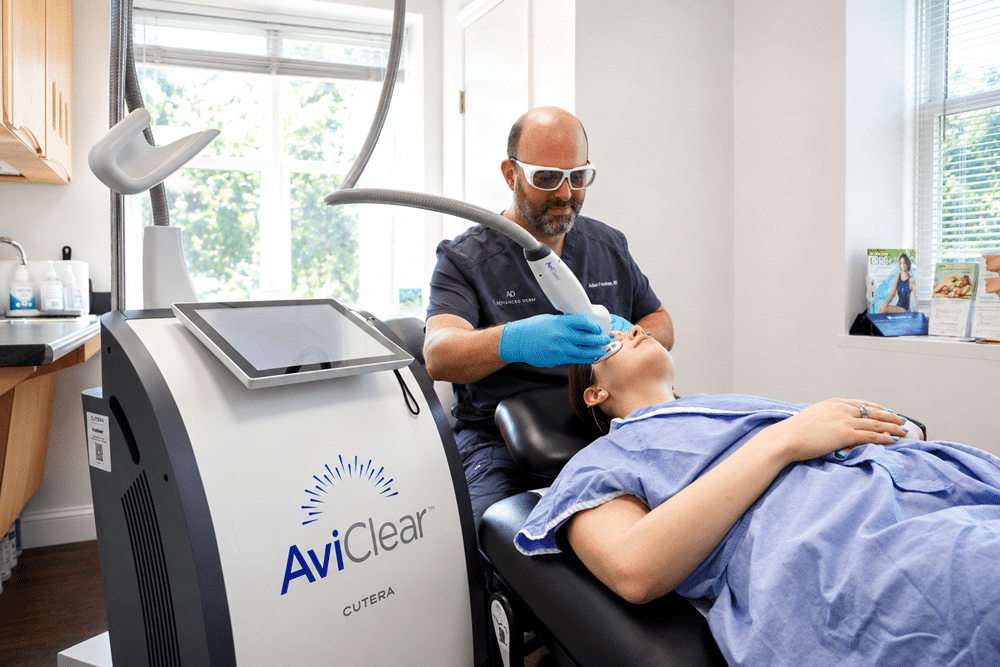 laser acne treatment patient in new york