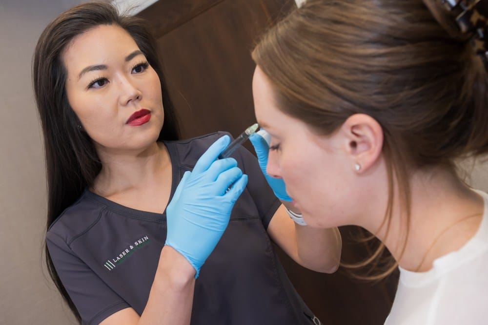 radiesse wrinkle treatments